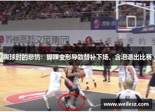 踢球时的悲情：脚踝变形导致替补下场，含泪退出比赛